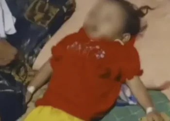 Cegah Tragedi: Siklus Hidup Cacing yang Mengancam Anak menurut Profesor UI