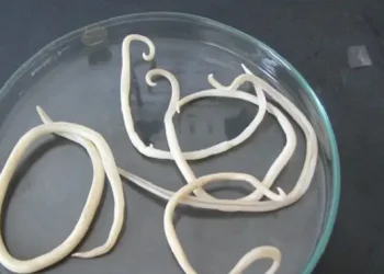Cacing Gelang yang Menginfeksi Anak di Sukabumi Panjangnya Bisa Mencapai 35 Cm