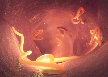 Kasus Cacingan Menurun Menurut Kemenkes Ingatkan Risiko Infeksi Berulang