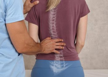 Skoliosis Tidak Boleh Diremehkan, Berikut Langkah Pencegahan dan Penanganan yang Tepat