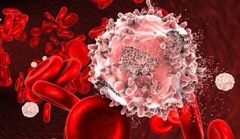 Mengenal Multiple Myeloma, Kanker Darah yang Sering Terlambat Terdeteksi