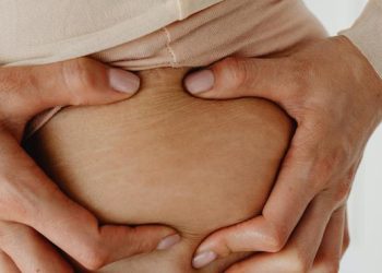 Pria Juga Mengalami Stretch Mark: Fakta, Penyebab, dan Cara Mencegahnya
