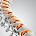 Tulang Rapuh Tidak Tiba-Tiba, Kenali Gejala Osteoporosis Sejak Awal