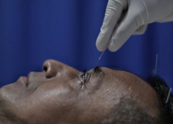 Manfaat Terapi Akupunktur untuk Kesehatan dan Penyembuhan