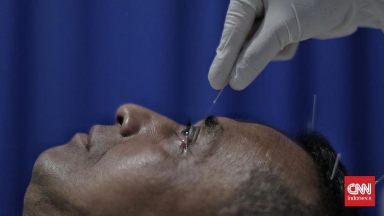 Manfaat Terapi Akupunktur untuk Kesehatan dan Penyembuhan