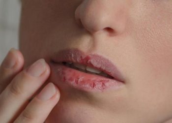 9 Kebiasaan Harian yang Menyebabkan Bibir Kering dan Mengelupas