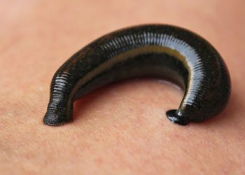 Mimisan Berhari-hari, Lintah Ditemukan Bersarang di Hidung Seorang Pria