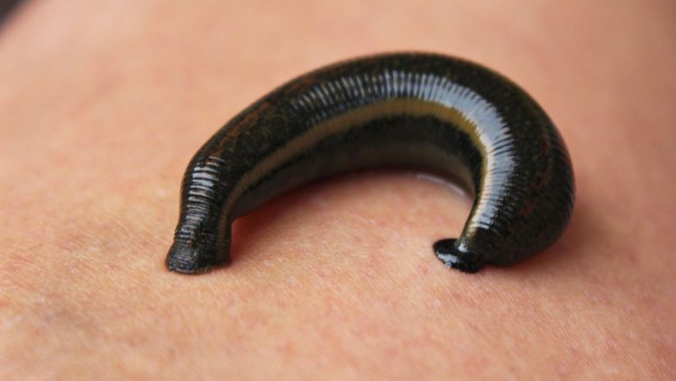 Mimisan Berhari-hari, Lintah Ditemukan Bersarang di Hidung Seorang Pria