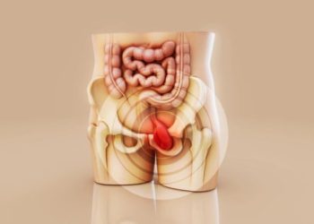 Takut Anak Mandul Akibat Operasi Hernia Simak Penjelasan Dokter