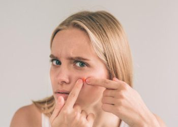 Kenali 13 Jenis Jerawat dan Cara Mengatasi Jerawat yang Berbeda-Beda