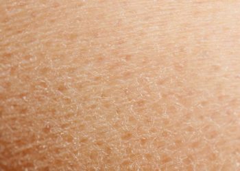 7 Bahan Alami untuk Mengatasi Kulit Kering yang Mudah Ditemukan di Dapur