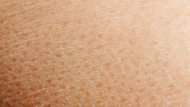 7 Bahan Alami untuk Mengatasi Kulit Kering yang Mudah Ditemukan di Dapur