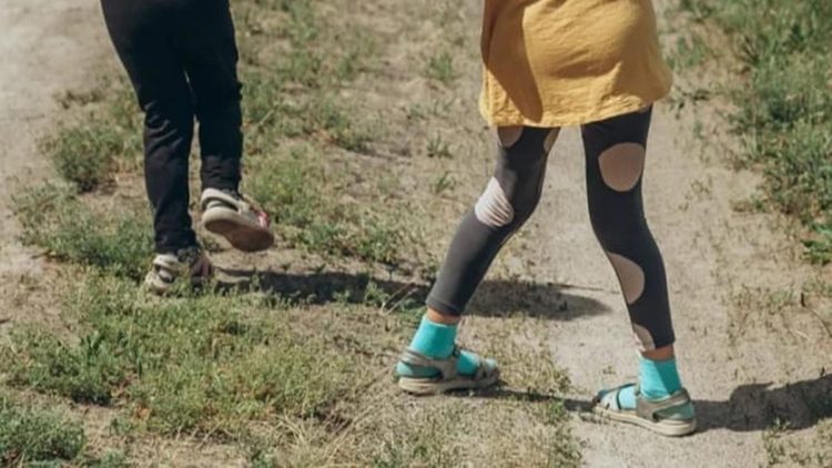 Mengatasi Kaki O dan X pada Anak Secara Alami