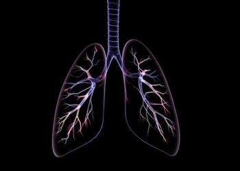 Emboli Paru Mematikan Seketika Awal dari Bekuan Darah